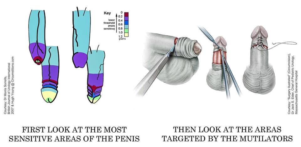 Most Sensitive Parts Of The Penis 99